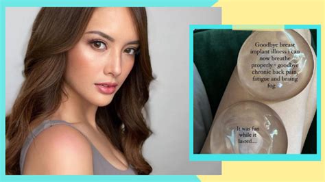 Ellen Adarna gets breast implants removed: It was fun while it。